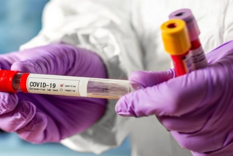 Количество новых случаев коронавируса на Днепропетровщине за прошедшие сутки