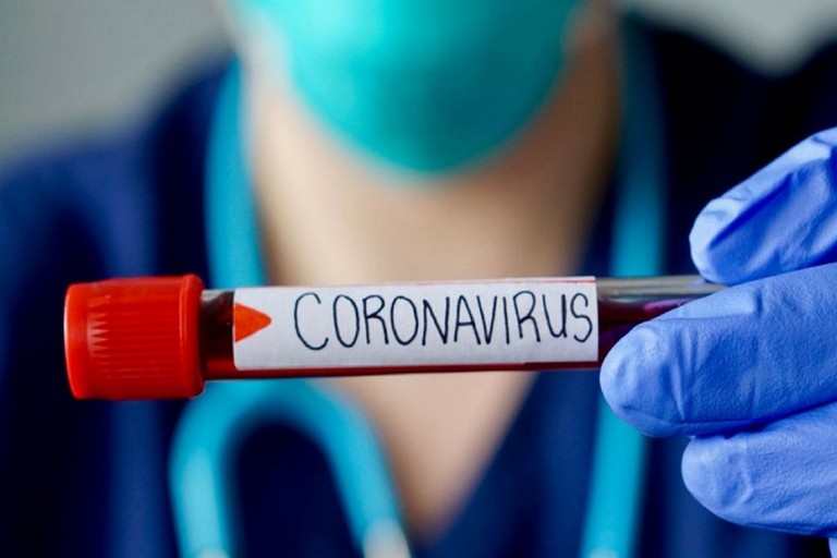 [:ru]Количество новых случаев коронавируса в Никополе и Покрове на 7 апреля[:ua]Кількість нових випадків коронавірусу у Нікополі та Покрові на 7 квітня[:]