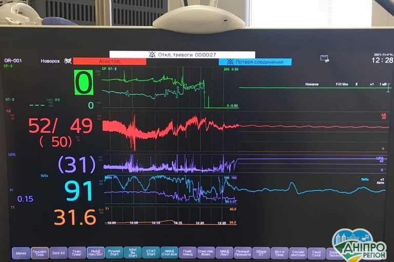 Сердце младенца остановили на 38 минут: в Днепре впервые провели уникальную операцию