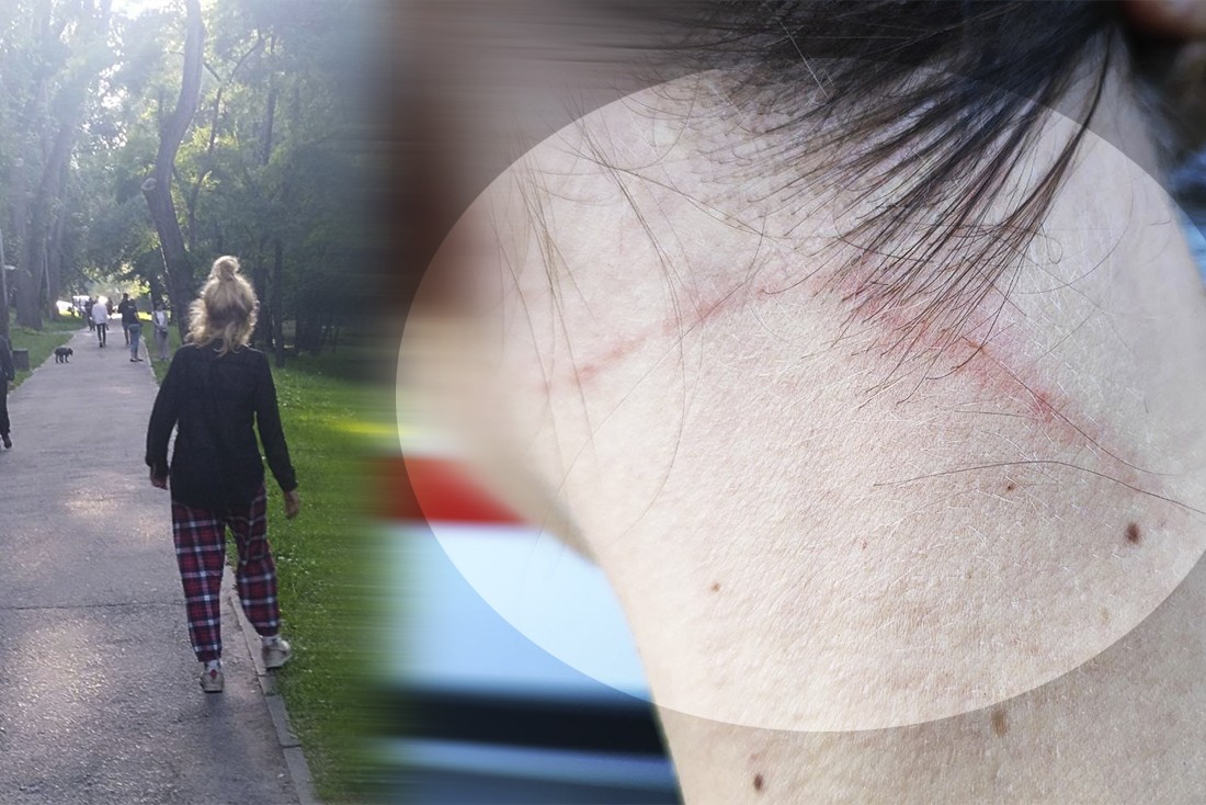 Душила фонендоскопом і роздерла шию: на Дніпропетровщині п’яна жінка напала на медиків швидкої