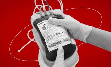 Пораненим потрібно багато крові: ГЗК Покрова організовує поїздки в Нікополь для донорів
