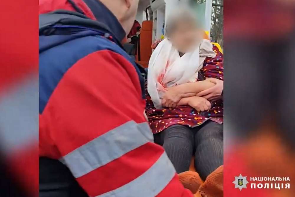 Відео порятунку 87-річної пораненої бабусі у Нікополі показала поліція – всього травмованих троє