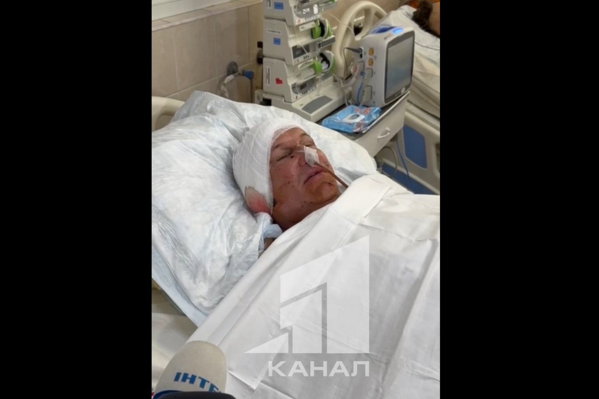 У Нікополі отримав поранення комунальник, який приїхав фіксувати наслідки попередньої атаки (відео)