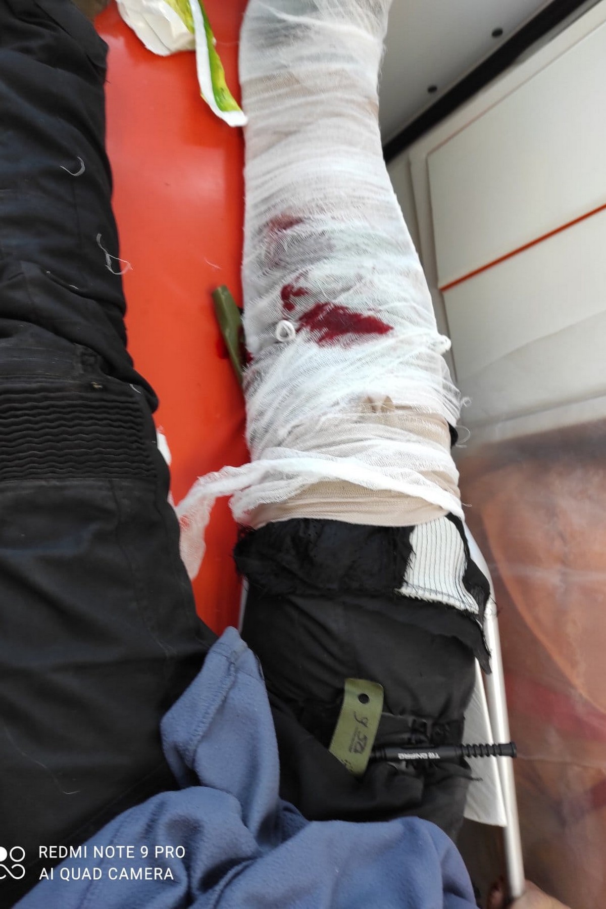 Двоє загиблих, троє поранених: деталі про моторошну ДТП на Нікопольщині розповіли медики