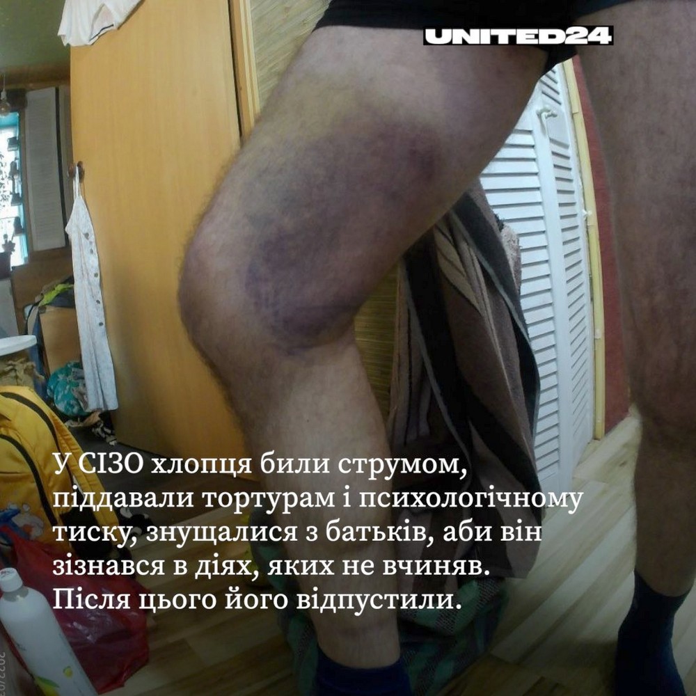 Енергодарець Денис втік з російського полону: як склалася його доля