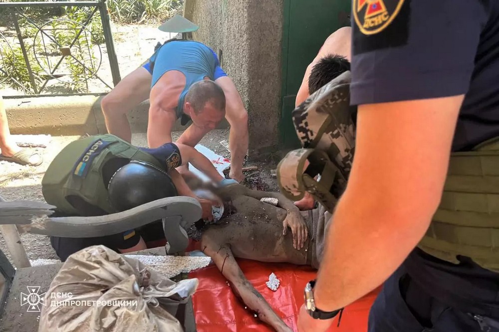 Перебував на подвір'ї власного будинку: у Нікополі ворог поранив чоловіка 1 у Нікополі ворог поранив чоловіка