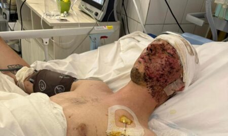 Отримав важке поранення внаслідок прямого влучання в бліндаж: захиснику з Нікопольщини потрібна допомога 23 захиснику з Нікопольщини потрібна допомога 2