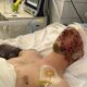 захиснику з Нікопольщини потрібна допомога 2