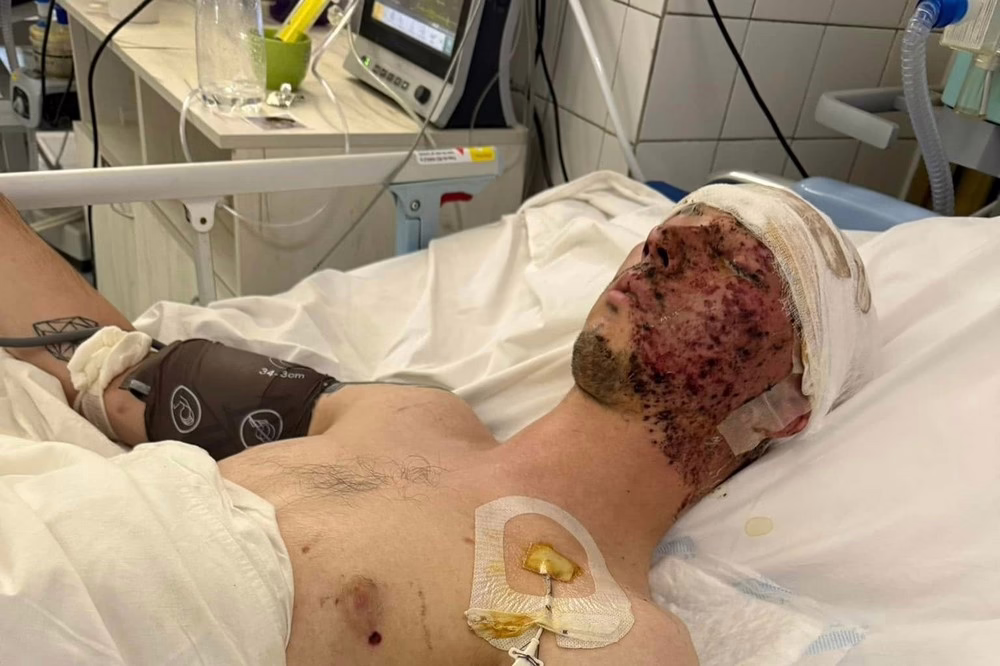 захиснику з Нікопольщини потрібна допомога 2
