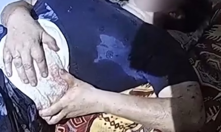 У Нікополі дрон влучив у автівку з людьми: поліція евакуювала поранену жінку до лікарні (відео)