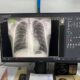 Як працює рентген кабінет у дитячій лікарні Нікополя до 27 серпня