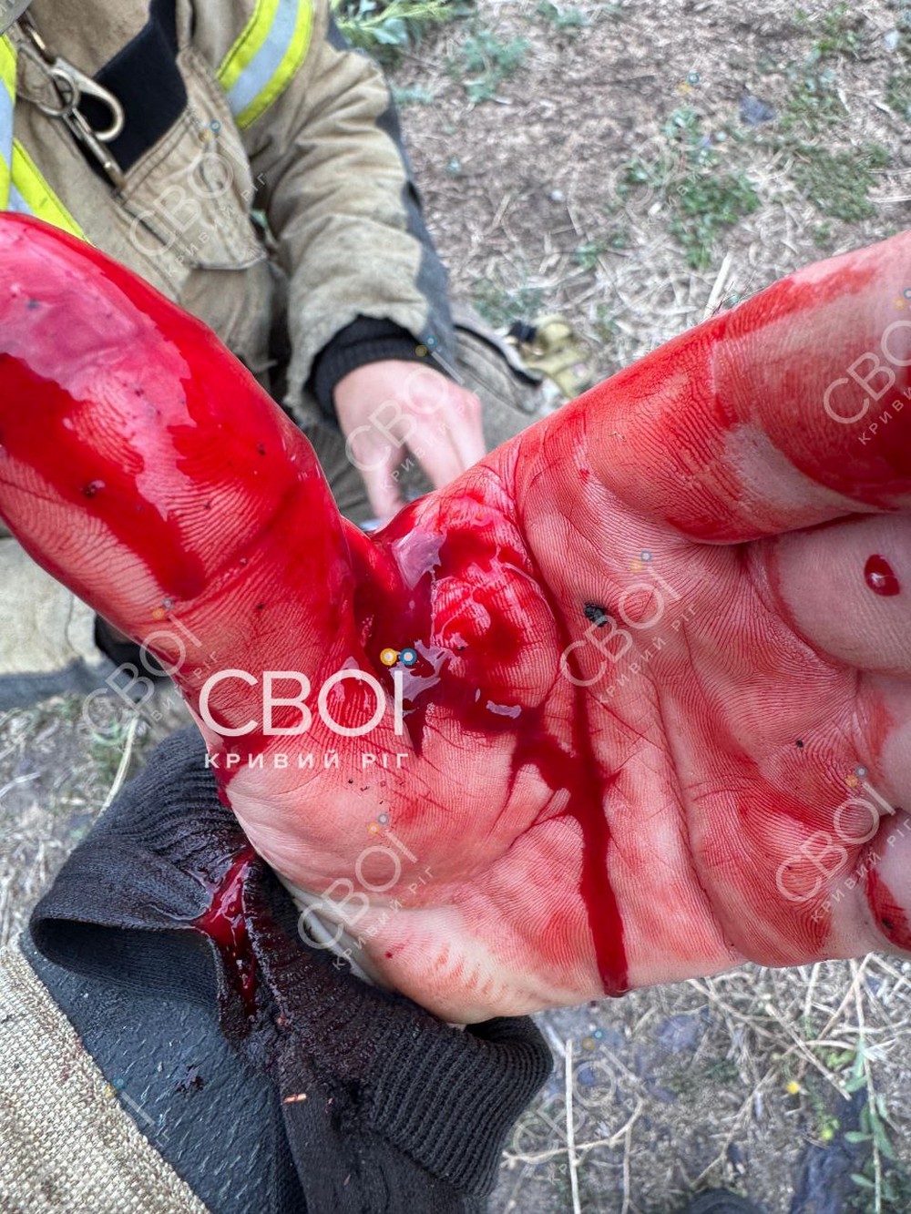 Нападника поліцейські застрелили на місці: подробиці резонансної події на Криворіжжі (фото)