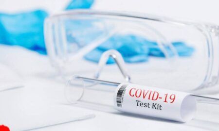 Дві смерті від COVID-19 і поширення педикульозу: епідемічна ситуація на Дніпропетровщині станом на 27 серпня