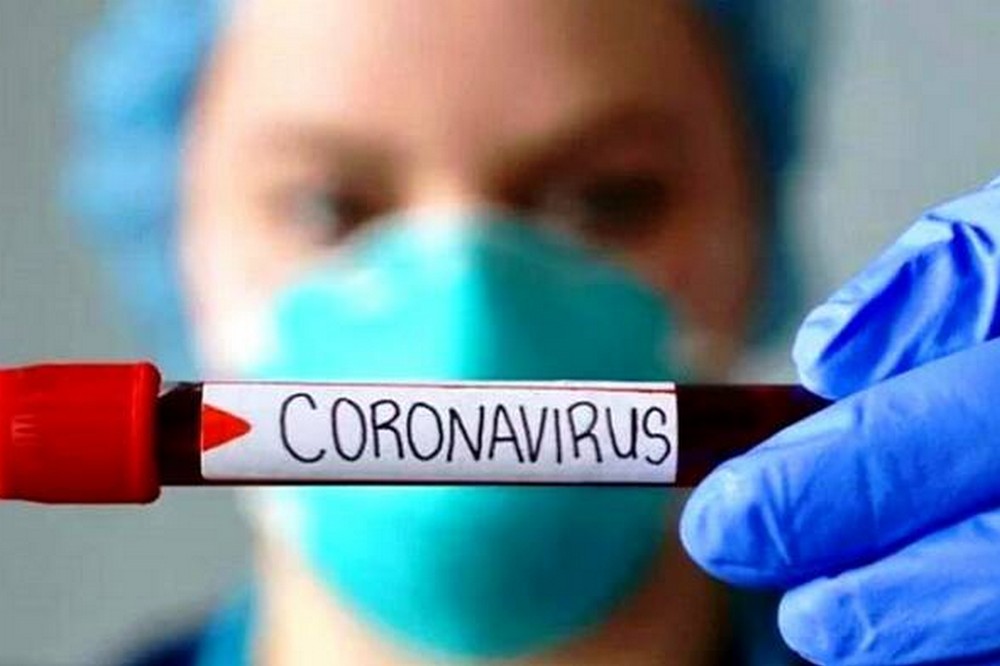 у Дніпропетровській області на 57% зросла кількість випадків COVID 19 Микола Лукашук 2