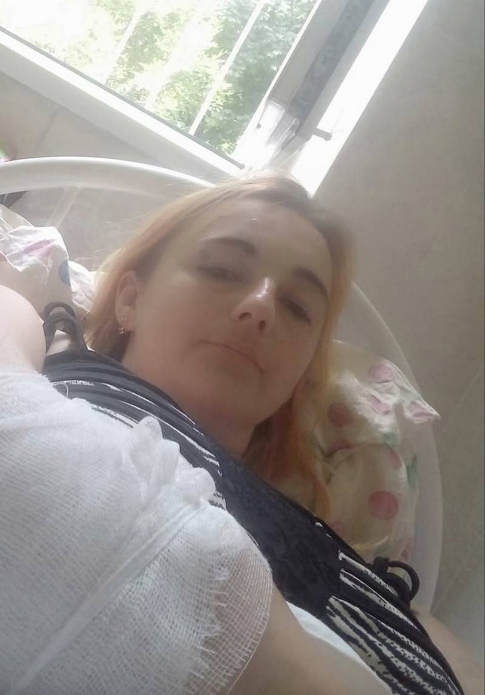 В Покрові знову собаки напали на дитину