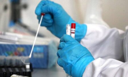 Зростання COVID-19, ботулізм і сказ серед тварин: епідемічна ситуація на Дніпропетровщині