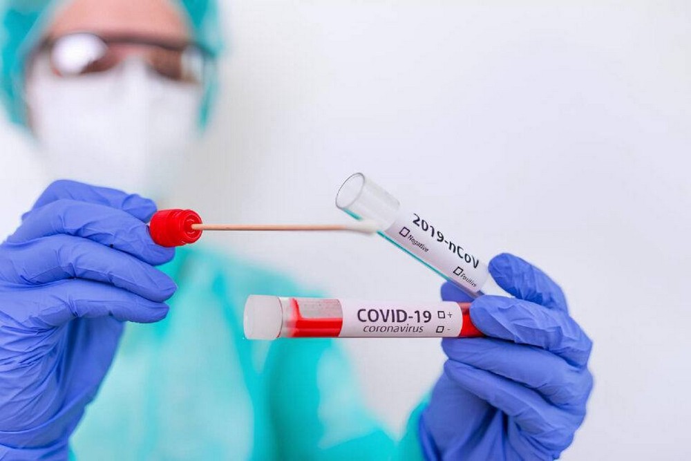 Троє померлих від COVID-19, отруєння грибами, сказ і зростання кількості ГРВІ: епідеміологічна ситуація на Дніпропетровщині 1 Троє померлих від COVID-19, отруєння грибами, сказ і зростання кількості ГРВІ: епідеміологічна ситуація на Дніпропетровщині