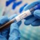 П’ятеро померлих від COVID-19, кишкові інфекції і отруєння грибами: епідеміологічна ситуація на Дніпропетровщині на цьому тижні