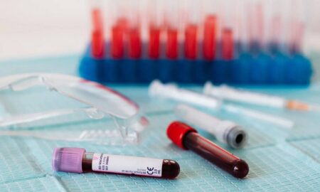 COVID-19 відступає, ГРВІ побільшало, 5 людей отруїлися грибами: епідеміологічна ситуація на Дніпропетровщині