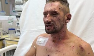 Обгоріле обличчя було схоже на мумію: у Дніпрі рятують журналіста, який єдиний вижив під час удару по знімальній групі Freedom у Краматорську