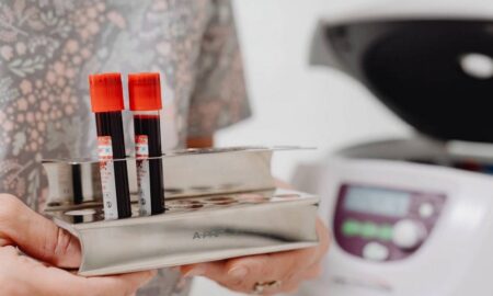 епідеміологічна ситуація на Дніпропетровщині 2