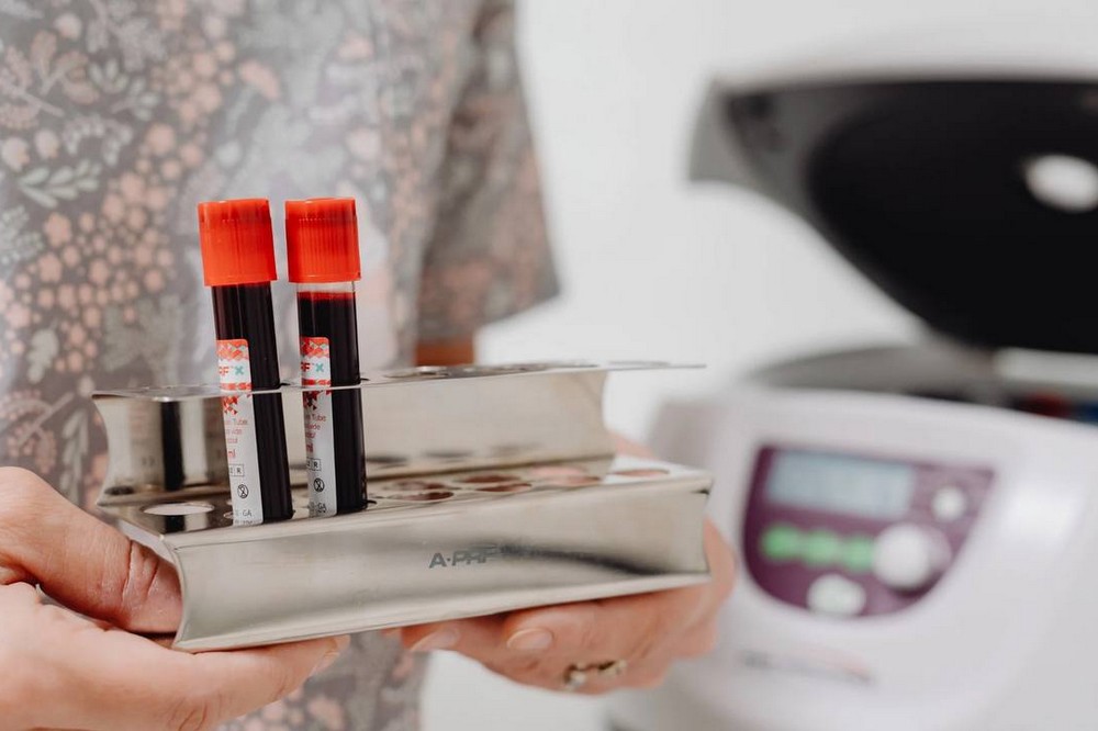 Кількість хворих на ГРВІ зменшується: яка епідеміологічна ситуація на Дніпропетровщині, розповів Микола Лукашук 1 епідеміологічна ситуація на Дніпропетровщині 2