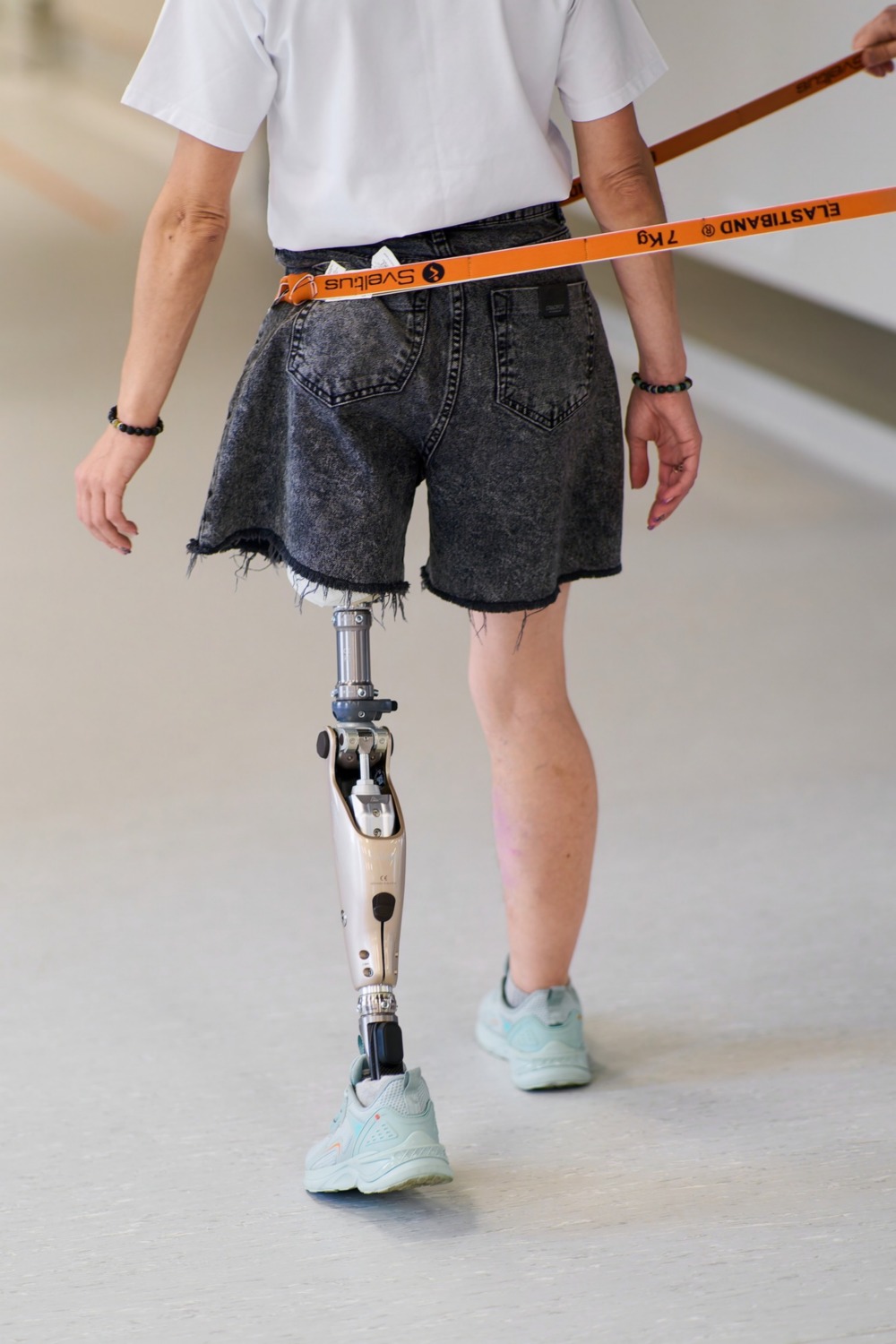 як поранена у Нікополі жінка проходить реабілітацію в центрі Superhumans (відео) 2