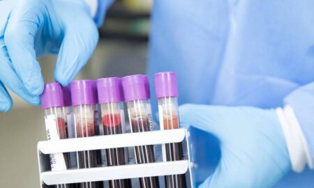 Захворюваність на COVID-19 та ГРВІ стрімко йде на спад: епідеміологічна ситуація на Дніпропетровщині