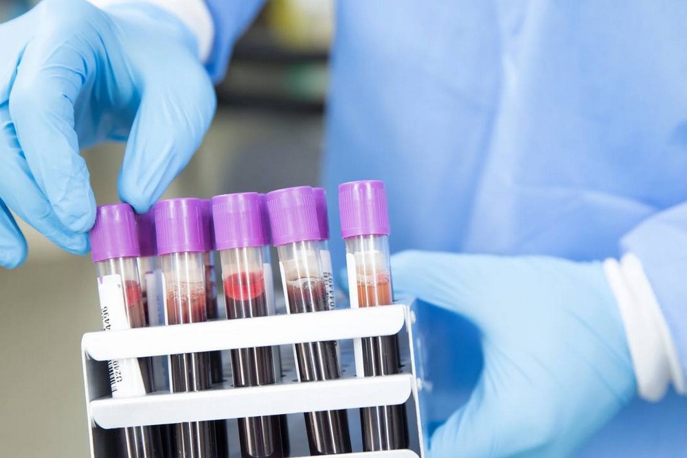 Епідеміологічна ситуація на Дніпропетровщині