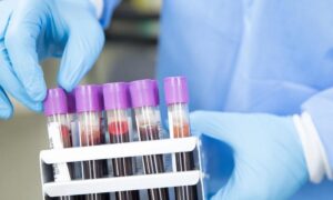 епідеміологічна ситуація на Дніпропетровщині