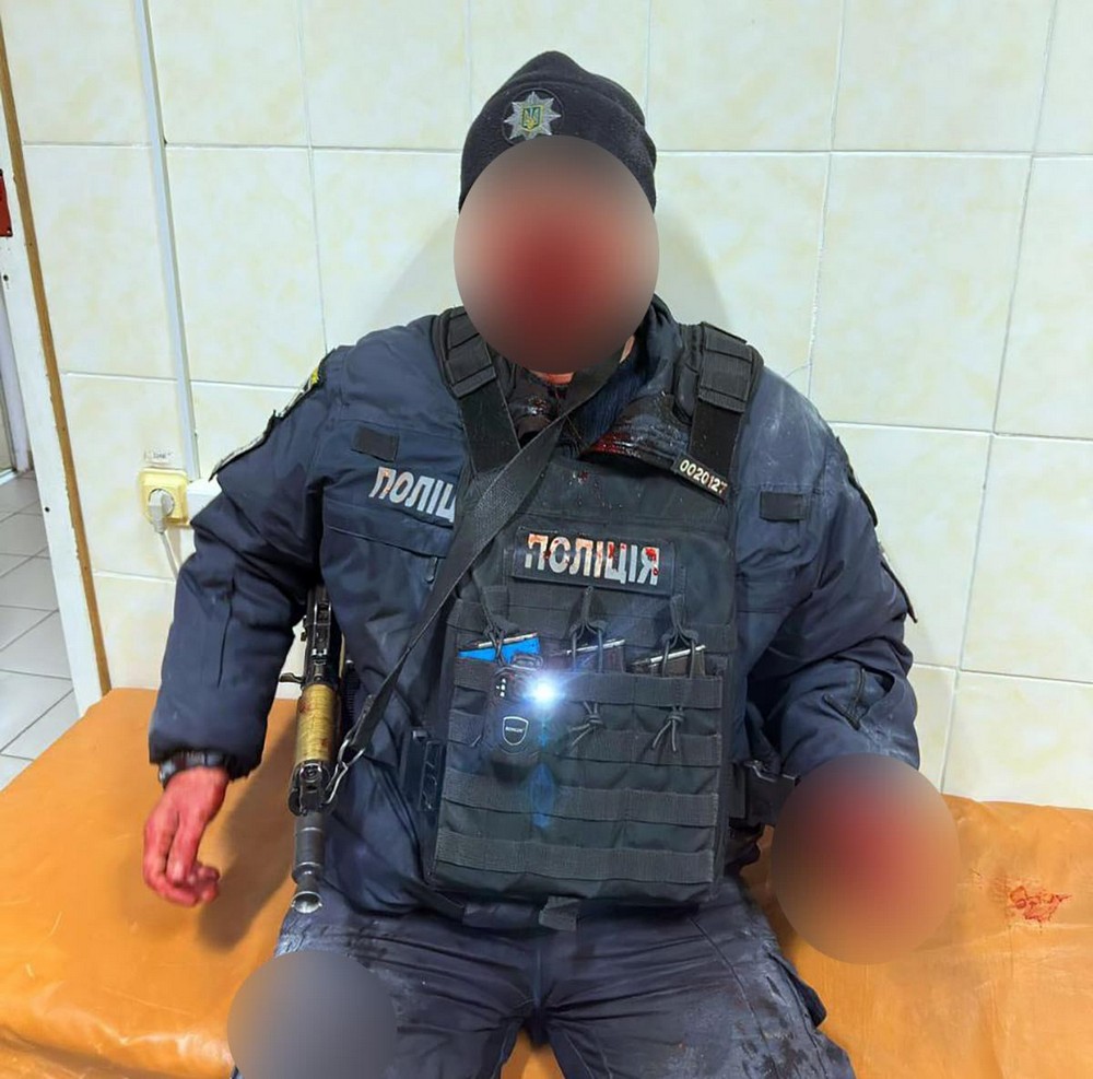 Внаслідок обстрілу Нікопольщини постраждали двоє поліцейських: подробиці Внаслідок обстрілу Нікопольщини постраждали двоє поліцейських: подробиці