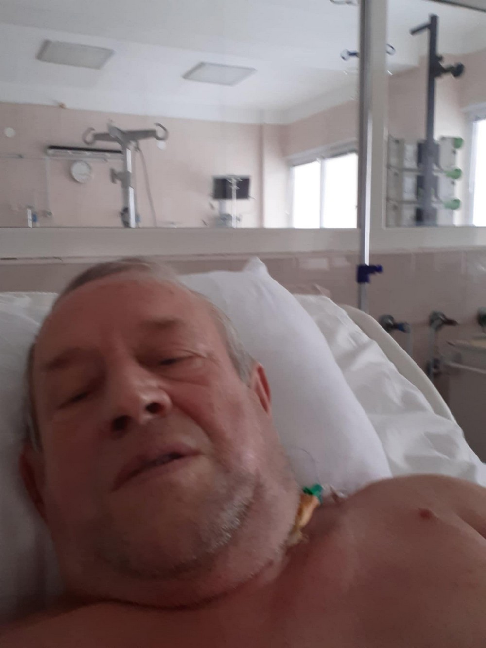 Пішов забрати яйця для випічки і потрапив під атаку дрона: чоловіку волонтерки з Нікополя потрібна допомога