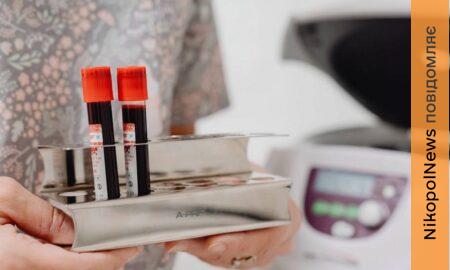 епідеміологічна ситуація на Дніпропетровщині