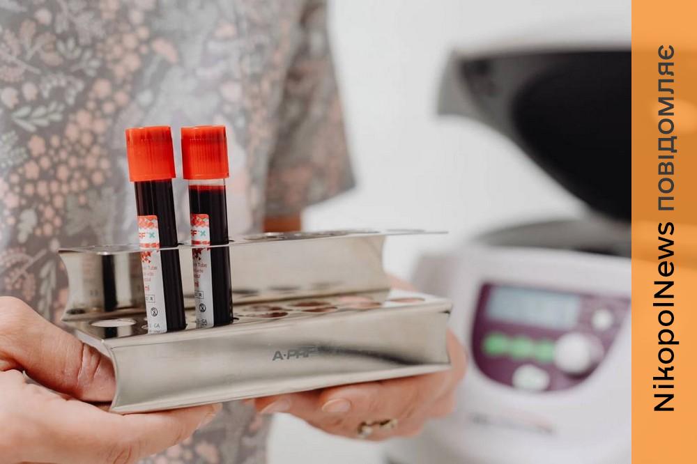 епідеміологічна ситуація на Дніпропетровщині