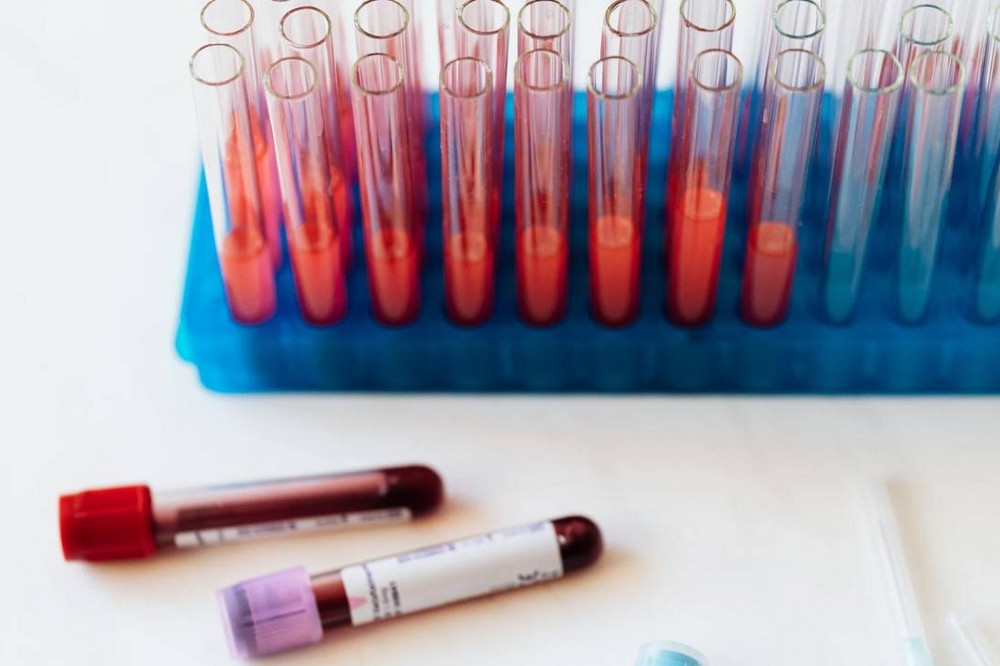 епідеміологічна ситуація на Дніпропетровщині 2