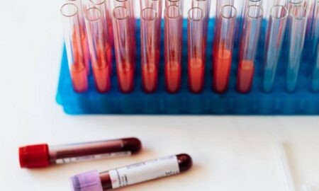 Захворюваність на ГРВІ знизилася на 25,6%: яка епідеміологічна ситуація на Дніпропетровщині на цьому тижні