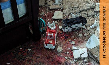 Ракетний удар по Кривому Рогу 22 січня: серед поранених 1,5-річний хлопчик – все, що відомо (фото)