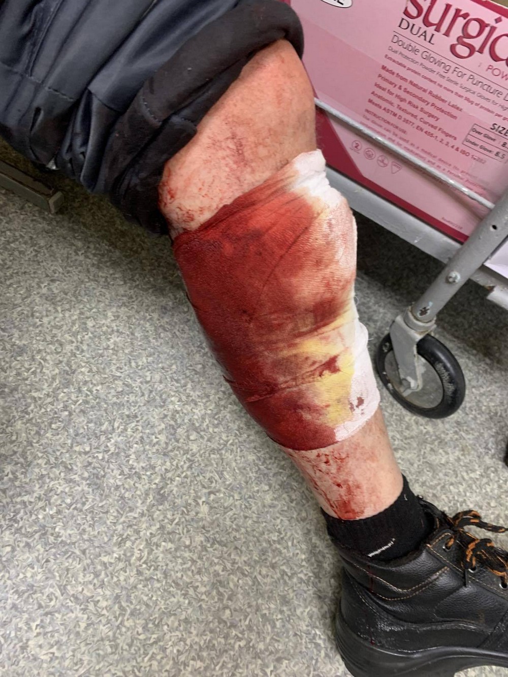 Троє газовиків на Нікопольщині потрапили під прицільну атаку FPV-дронів Троє газовиків на Нікопольщині потрапили під прицільну атаку FPV-дронів