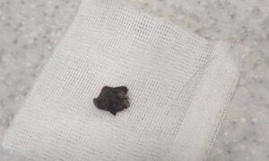 У Нікополі з шиї собаки