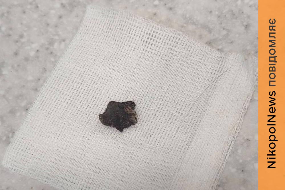 У Нікополі з шиї собаки