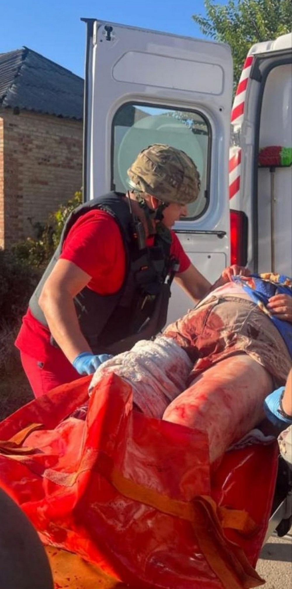 «Людина може стекти кров’ю за 1-3 хвилини»: медик з Нікополя розповів про свою роботу у прифронтовому місті (фото) «Людина може стекти кров’ю за 1-3 хвилини»: медик з Нікополя розповів про свою роботу у прифронтовому місті (фото)