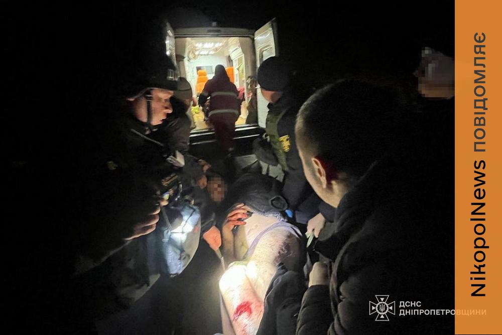 Поранені, пожежі, руйнування: про наслідки обстрілів Нікопольщини, Синельниківщини і Павлоградщини розповіли у ДСНС (фото) 1 Нікополь