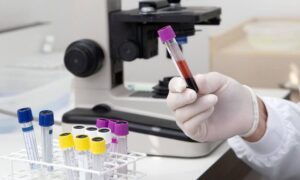 епідеміологічна ситуація на Дніпропетровщині 2