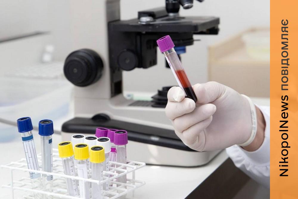 епідеміологічна ситуація на Дніпропетровщині 2