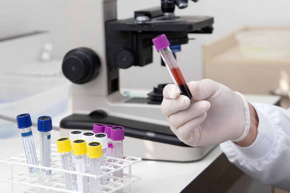 епідеміологічна ситуація на Дніпропетровщині 2 епідеміологічна ситуація на Дніпропетровщині 2