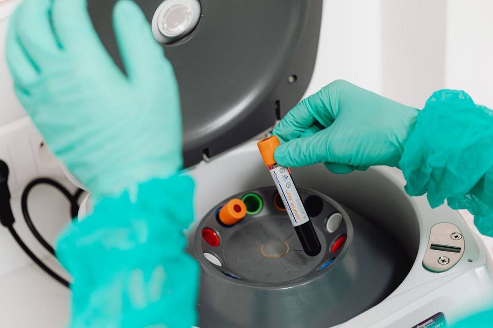 епідеміологічна ситуація