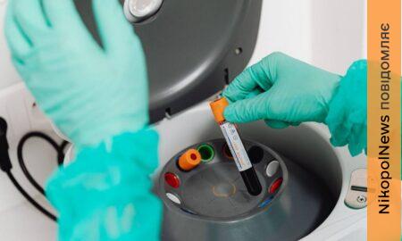 яка епідеміологічна ситуація на Дніпропетровщині 2