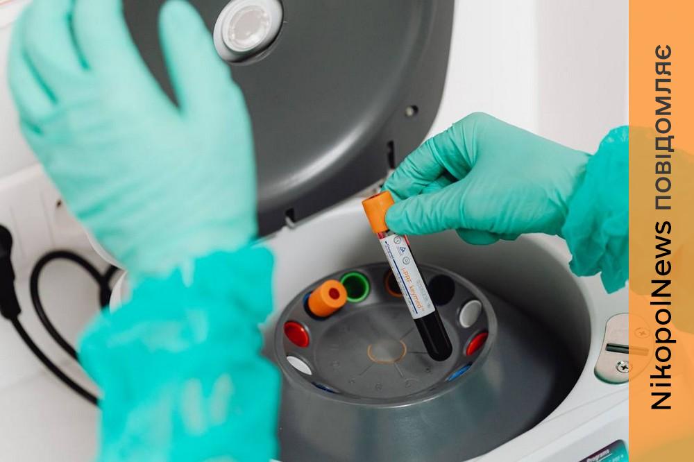 яка епідеміологічна ситуація на Дніпропетровщині 2