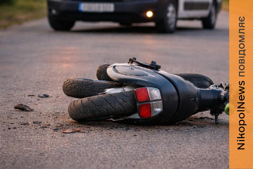 На Дніпропетровщині авто збило 11-річного хлопчика, який їхав на скутері без шолому – дитина отримала важкі травми