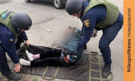 У Нікополі важко поранено 16-річну доньку журналіста – потрібна допомога